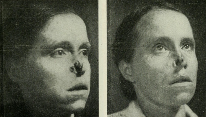 Las chicas del radio